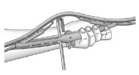 7. Reinstall the wiper blade